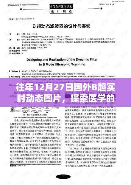 医学奥秘揭秘,历年国外B超实时动态图片探索