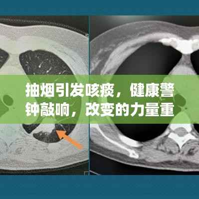 抽烟引发咳痰,健康警钟敲响,改变的力量重塑生命健康之路