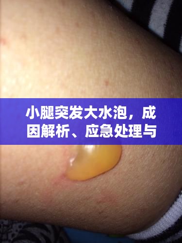 小腿突发大水泡,成因解析、应急处理与预防策略
