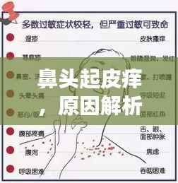 鼻头起皮痒,原因解析、处理方法与预防策略