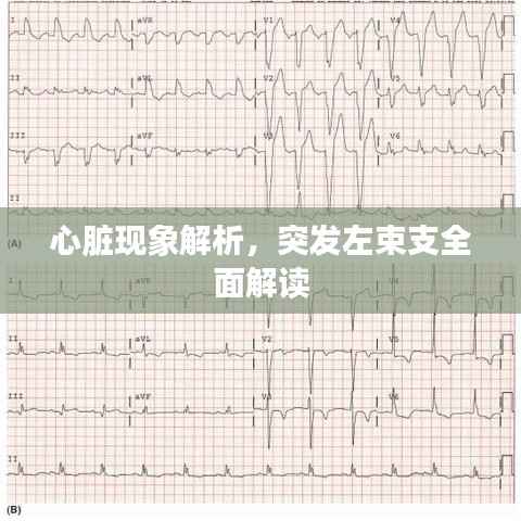 心脏现象解析，突发左束支全面解读