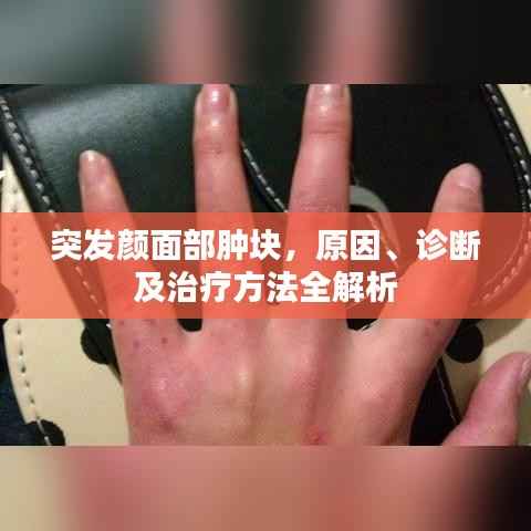 突发颜面部肿块,原因、诊断及治疗方法全解析