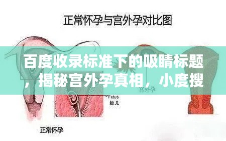 百度收录标准下的吸睛标题,揭秘宫外孕真相,小度搜索带你深入了解!