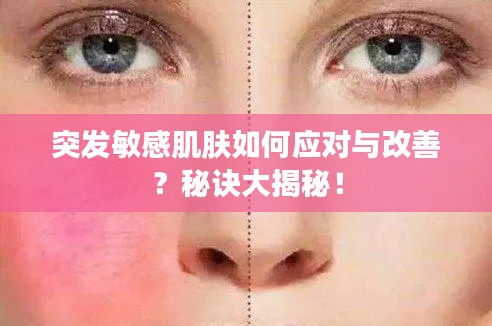 突发敏感肌肤如何应对与改善?秘诀大揭秘!