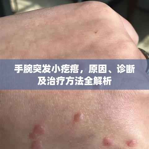 手腕突发小疙瘩,原因、诊断及治疗方法全解析