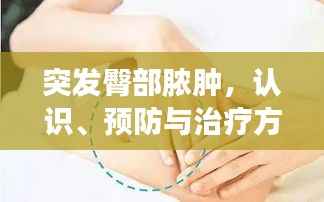 突发臀部脓肿，认识、预防与治疗方法