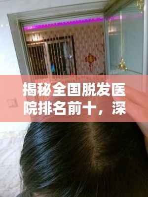 揭秘全国脱发医院排名前十,深度解析治疗脱发最佳选择!