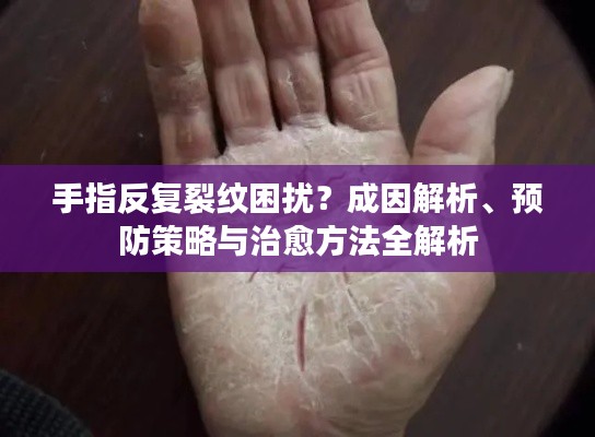 手指反复裂纹困扰？成因解析、预防策略与治愈方法全解析
