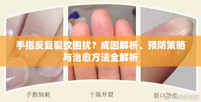 手指反复裂纹困扰?成因解析、预防策略与治愈方法全解析