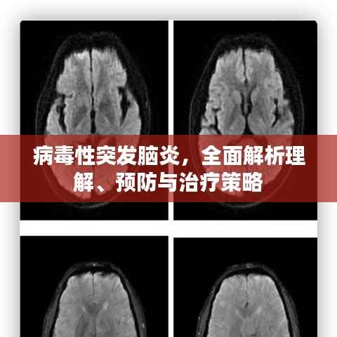 病毒性突发脑炎，全面解析理解、预防与治疗策略