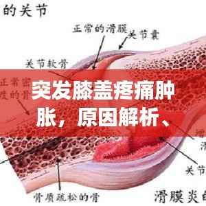 突发膝盖疼痛肿胀，原因解析、应急处理与预防策略