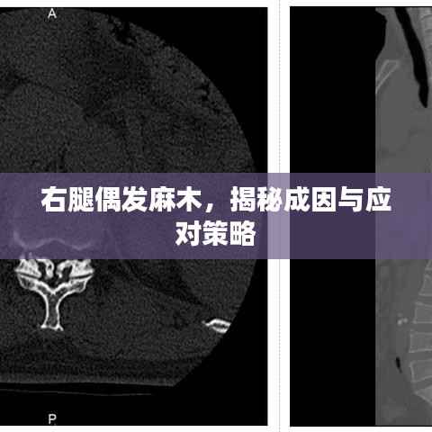 右腿偶发麻木，揭秘成因与应对策略